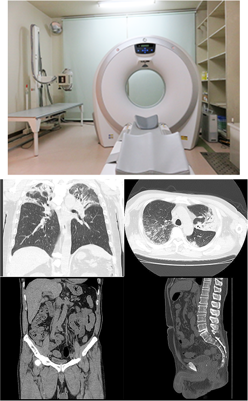 CT　（Computed Tomography）